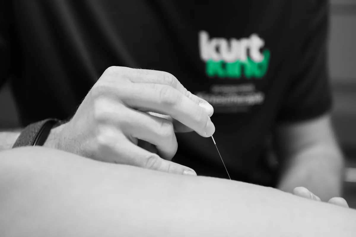 Dry needling